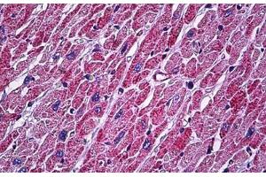 Human Heart: Formalin-Fixed, Paraffin-Embedded (FFPE) (ATP5A1 antibody  (AA 201-250))