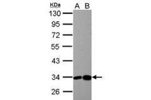 Image no. 4 for anti-3-hydroxyisobutyrate Dehydrogenase (HIBADH) (AA 1-257) antibody (ABIN1501919)