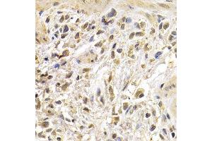 Immunohistochemistry (IHC) image for anti-Jun Proto-Oncogene (JUN) (AA 1-70) antibody (ABIN6213718) (C-JUN antibody  (AA 1-70))