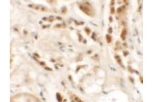 Immunohistochemical analysis of SIGLEC15 in human kidney tissue with SIGLEC15 polyclonal antibody  at 2.