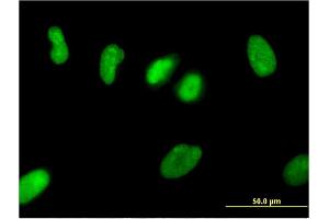Immunofluorescence of monoclonal antibody to ZNF101 on HeLa cell.