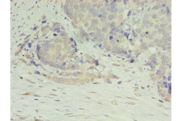 DIP2A antibody  (AA 1-300)