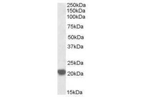 Image no. 1 for anti-Ras-Related C3 Botulinum Toxin Substrate 2 (Rho Family, Small GTP Binding Protein Rac2) (RAC2) (C-Term) antibody (ABIN374166) (RAC2 antibody  (C-Term))