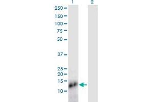 Western Blot analysis of SPRR4 expression in transfected 293T cell line by SPRR4 monoclonal antibody (M04), clone 1G5. (SPRR4 antibody  (AA 1-79))