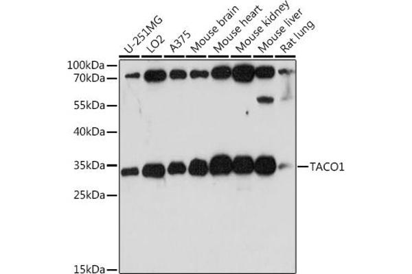 TACO1 Antikörper  (AA 1-297)