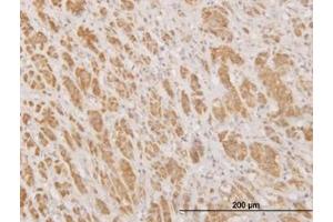 Image no. 1 for anti-N-Methylpurine-DNA Glycosylase (MPG) (AA 1-90) antibody (ABIN598820) (MPG antibody  (AA 1-90))