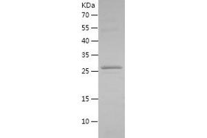Western Blotting (WB) image for FXYD Domain Containing Ion Transport Regulator 3 (FXYD3) (AA 21-87) protein (His-IF2DI Tag) (ABIN7283817) (FXYD3 Protein (AA 21-87) (His-IF2DI Tag))
