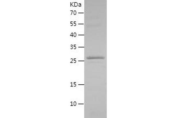 FXYD3 Protein (AA 21-87) (His-IF2DI Tag)