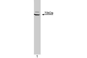 Western blot analysis of ZAP-70 Kinase on a Jurkat cell lysate (Human T-cell leukemia, ATCC TIB-152). (ZAP70 antibody  (AA 468-619))