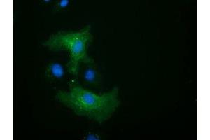 Anti-ALDH1L1 mouse monoclonal antibody (ABIN2452750) immunofluorescent staining of COS7 cells transiently transfected by pCMV6-ENTRY ALDH1L1 (RC213720). (ALDH1L1 antibody)