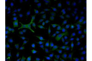 Image obtained from One World Lab validations program. (Complement Factor B antibody  (AA 301-400))