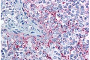 Human Tonsil (formalin-fixed, paraffin-embedded) stained with MTBP antibody ABIN213954 at 10 ug/ml followed by biotinylated goat anti-rabbit IgG secondary antibody ABIN481713, alkaline phosphatase-streptavidin and chromogen. (MTBP antibody  (AA 122-139))