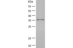 Western Blotting (WB) image for Aflatoxin Beta1 Aldehyde Reductase (AKR7A2) (AA 1-359) protein (His tag) (ABIN7284445) (AKR7A2 Protein (AA 1-359) (His tag))