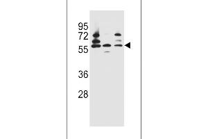 PDP1 Antibody (Center) (ABIN656386 and ABIN2845681) western blot analysis in Jurkat,HepG2,293 cell line lysates (35 μg/lane). (PDP antibody  (AA 308-336))