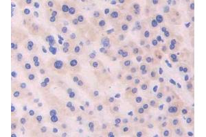 DAB staining on IHC-P; Samples: Human Liver Tissue (CDNF antibody  (AA 33-187))