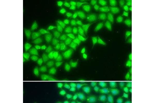METTL2A antibody