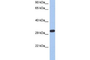 WB Suggested Anti-CAPZA3 Antibody Titration: 0. (CAPZA3 antibody  (N-Term))