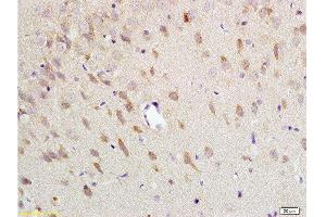 Formalin-fixed and paraffin embedded: rat brain tissue labeled with Anti-NK-2R Polyclonal Antibody , Unconjugated at 1:200 followed by conjugation to the secondary antibody and DAB staining