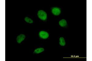 Immunofluorescence of purified MaxPab antibody to SS18 on HeLa cell. (SS18 antibody  (AA 1-418))