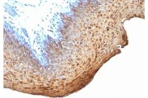 Formalin-fixed, paraffin-embedded human tonsil stained with Cytokeratin 10 + 13 antibody (DE-K13) (Keratin 10/13 antibody)