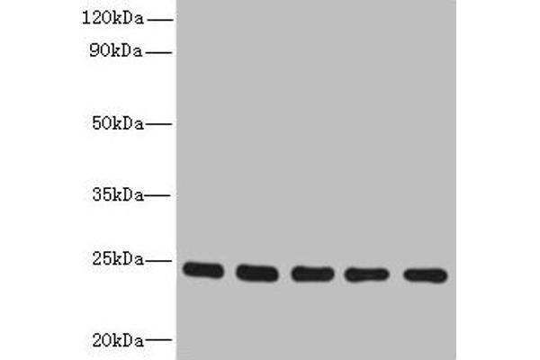 RAB6B antibody  (AA 2-208)