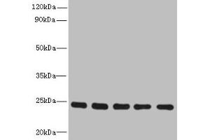 Western blot All lanes: RAB6B antibody at 5 μg/mL Lane 1: Mouse brain tissue Lane 2: U251 whole cell lysate Lane 3: MCF-7 whole cell lysate Lane 4: A549 whole cell lysate Lane 5: K562 whole cell lysate Secondary Goat polyclonal to rabbit IgG at 1/10000 dilution Predicted band size: 24, 23 kDa Observed band size: 24 kDa (RAB6B antibody  (AA 2-208))