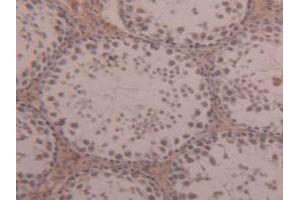 Immunohistochemistry (IHC) image for anti-alpha-2-Macroglobulin (A2M) (AA 1053-1214) antibody (ABIN1857846)