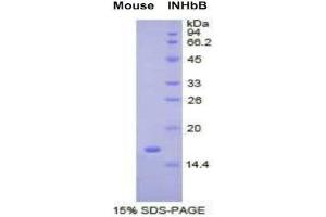 SDS-PAGE (SDS) image for Inhibin, beta B (INHBB) (AA 297-411) protein (His tag) (ABIN1079933)
