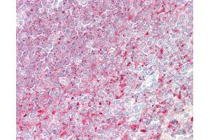 Anti-D52 / TPD52 antibody IHC staining of human spleen. (TPD52 antibody  (AA 213-223))