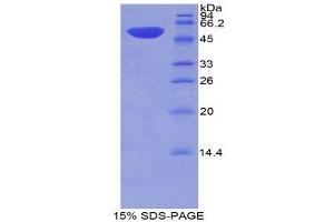 SDS-PAGE (SDS) image for Thrombospondin 2 (THBS2) (AA 968-1170) protein (His tag,GST tag) (ABIN1878912)