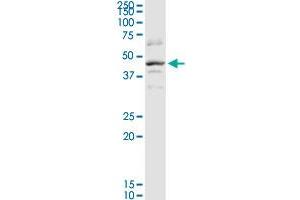 SERPINB2 MaxPab rabbit polyclonal antibody. (SERPINB2 antibody  (AA 1-415))
