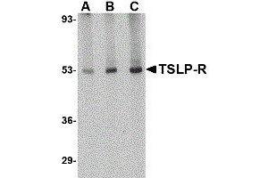 Western Blotting (WB) image for anti-Cytokine Receptor-Like Factor 2 (CRLF2) antibody (ABIN2476989) (CRLF2 antibody)