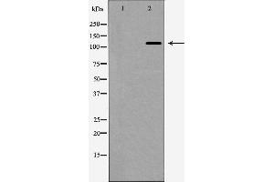 Western blot analysis of nNOS expression in HeLa cells,The lane on the left is treated with the antigen-specific peptide. (NOS1 antibody  (Internal Region))