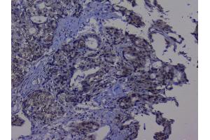 IHC analysis of NRF1 using anti-NRF1 antibody (ABIN6719347).