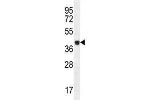 CASP5 antibody  (AA 162-191)