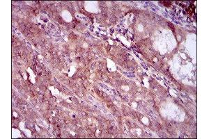 Immunohistochemistry (IHC) image for anti-EGFR Mutant (AA 693-893), (Mutant) antibody (ABIN1845729) (EGFR Mutant (AA 693-893), (Mutant) antibody)