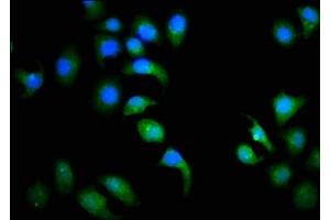 Immunofluorescence staining of A549 cells with ABIN7153394 at 1:113, counter-stained with DAPI.
