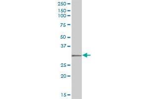 SULT1C1 MaxPab polyclonal antibody. (SULT1C2 antibody  (AA 1-296))