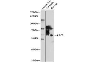 Western blot analysis of extracts of various cell lines, using  antibody (ABIN6129940, ABIN6137191, ABIN6137192 and ABIN6214455) at 1:1000 dilution. (ASIC3 antibody  (AA 62-320))