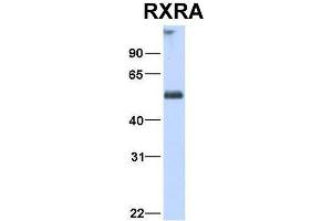 Host:  Rabbit  Target Name:  RXRA  Sample Type:  Human Fetal Heart  Antibody Dilution:  1. (Retinoid X Receptor alpha antibody  (N-Term))