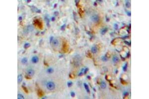 Used in DAB staining on fromalin fixed paraffin-embedded Liver tissue (Fc gamma RII (CD32) (AA 47-285) antibody)