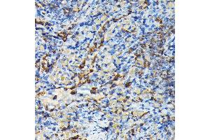 Immunohistochemistry of paraffin-embedded mouse spleen using PRC1 Rabbit pAb (ABIN6128502, ABIN6146124, ABIN6146125 and ABIN6222808) at dilution of 1:100 (40x lens). (PRC1 antibody  (AA 351-620))