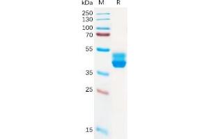 Human CB2 Protein, hFc Tag on SDS-PAGE under reducing condition. (CNR2 Protein (Fc Tag))