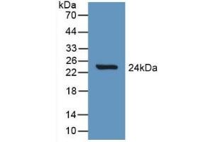 Detection of Recombinant Slit1, Rat using Polyclonal Antibody to Slit Homolog 1 (Slit1) (SLIT1 antibody  (AA 308-512))