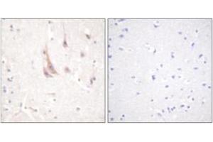 Immunohistochemistry analysis of paraffin-embedded human brain tissue, using PKC zeta (Ab-560) Antibody. (PKC zeta antibody  (AA 526-575))
