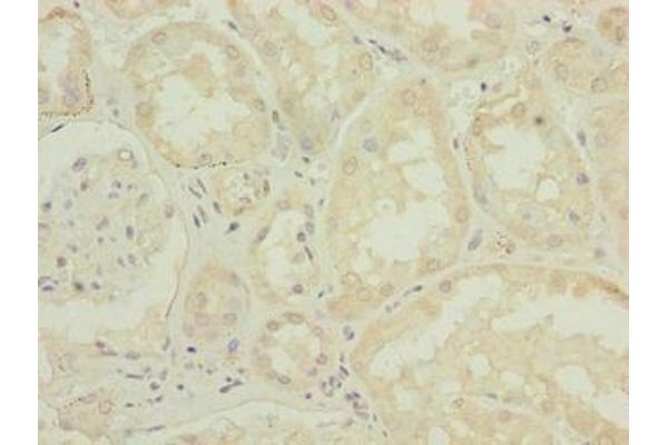ATPBD4 antibody  (AA 8-267)