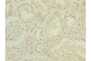 Immunohistochemistry of paraffin-embedded human kidney tissue using ABIN7150009 at dilution of 1:100 (ATPBD4 antibody  (AA 8-267))
