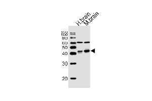 Western blot analysis of lysates from human brain, mouse brain tissue (from left to right), using WNT16 Antibody at 1:1000 at each lane. (WNT16 antibody  (C-Term))