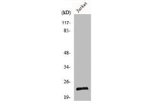 Western Blot analysis of Jurkat cells using Musculin Polyclonal Antibody (Musculin antibody  (C-Term))