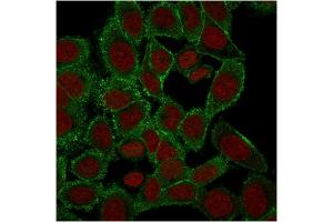 Immunofluorescence Analysis of PFA-fixed HeLa cells labeling with Moesin Mouse Monoclonal Antibody (rMSN/492) followed by Goat anti-Mouse IgG-CF488 (Green). (Recombinant Moesin antibody)